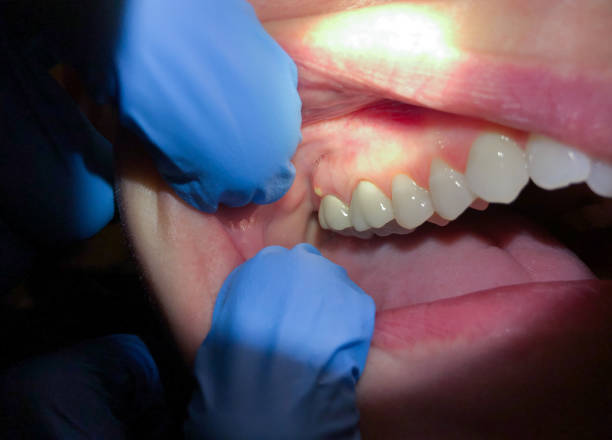 Best Mobile Emergency Dentist in Clifton Forge, VA