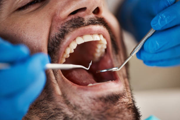 Best Orthodontic Emergency Dentist in Clifton Forge, VA